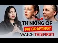 Fat Grafting: Does It Really Last? Don’t Do It Until You See This! #fatgrafting #cosmeticsurgery