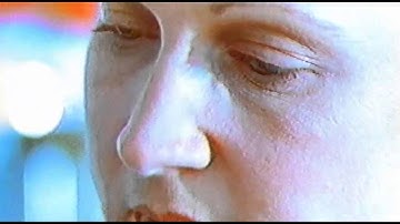 Patient Recruitment Example Type 2 Diabetes Clinical Research Study