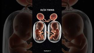 The "Perfect" Twin Split? 🤯 (Days 1-3) | Phân chia song sinh Di/Di #short