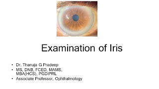 Iris examination
