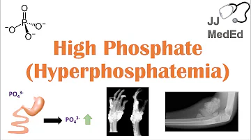 What foods are high in phosphate?