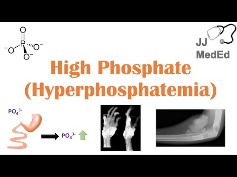 Video: Hipoproteinemie: Cauze, Tratament, Tipuri