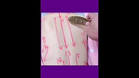 CẠO GIÓ VÙNG LƯNG #dinhdinh #kinhdoanhspa