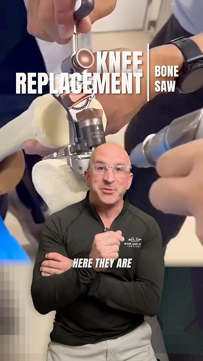 5 Bone Cuts for Knee Pain Relief #shorts #kneereplacementsurgeon