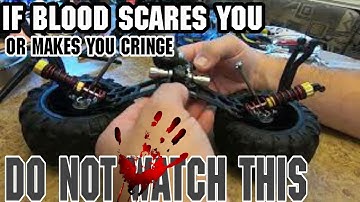 Hosim X07 Diff Reparatie