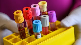 Drawing the Line: The Rationale Behind Blood Tube Collection Order