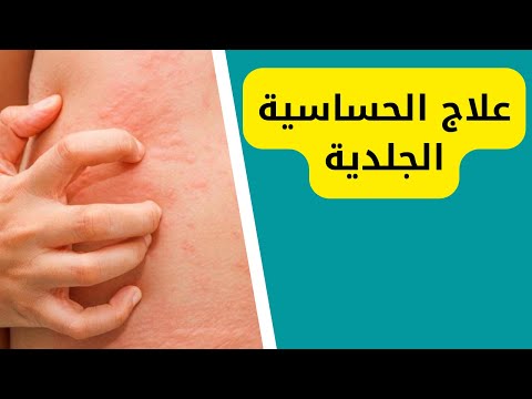 علاج الحساسية الجلدية هستوب 