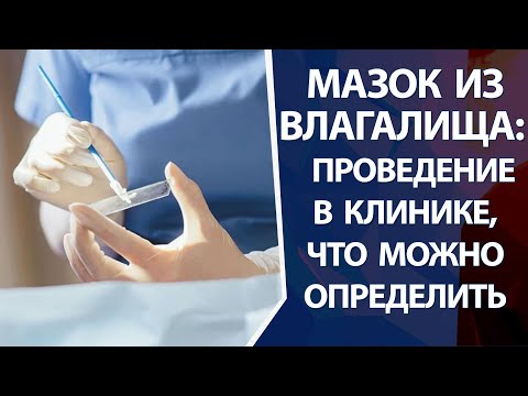 Мазок из влагалища