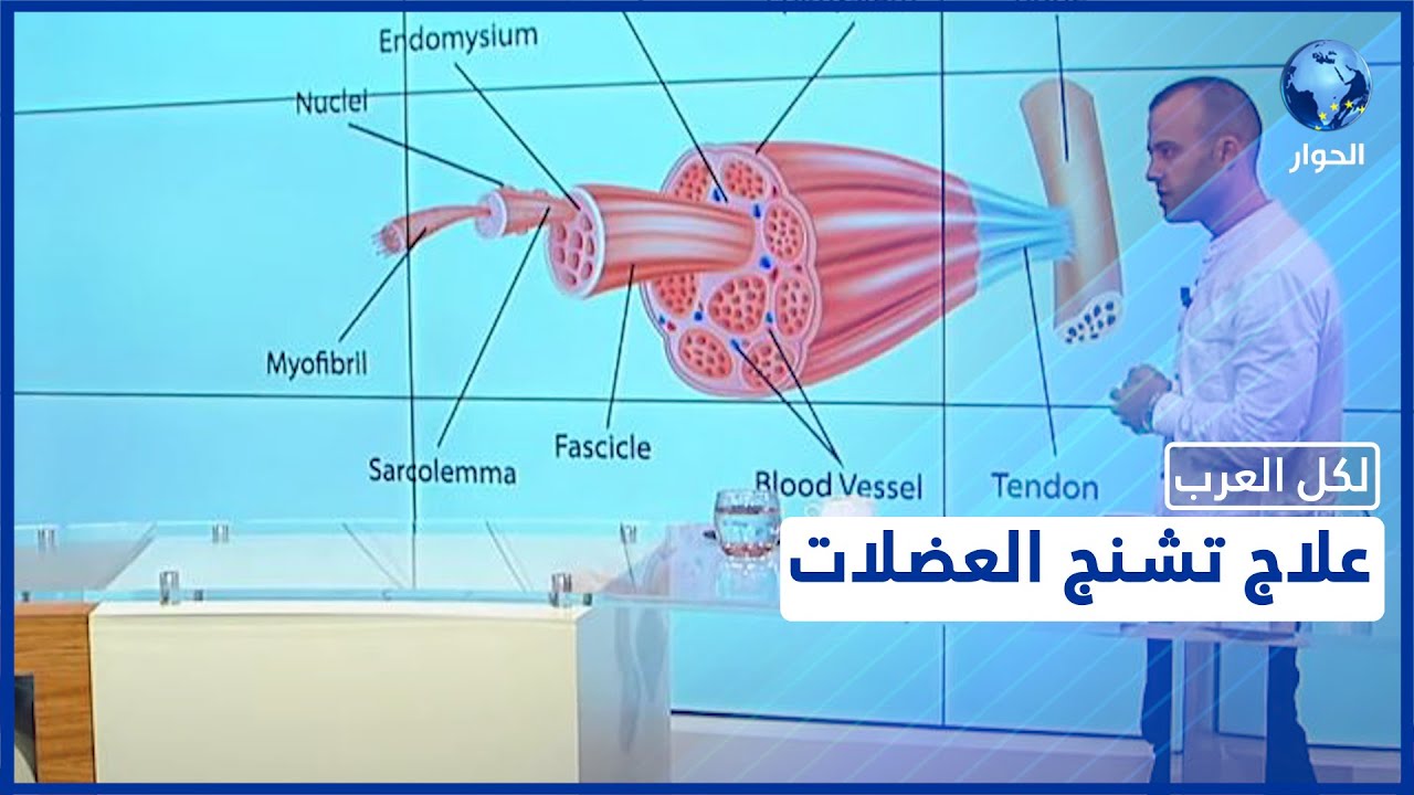 تعرّف على أسباب التشنجات العضلية وأعراضها وكيفية علاجها