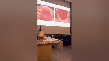 Cơ học dựng trục và di gần răng cối