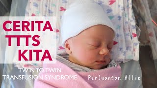 Cerita Kehamilan Kembar TTTS  - Twin to Twin Transfusion Syndrome - what to do