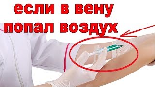 Что будет если сделать укол с воздухом в вену а если воздух уже в вене