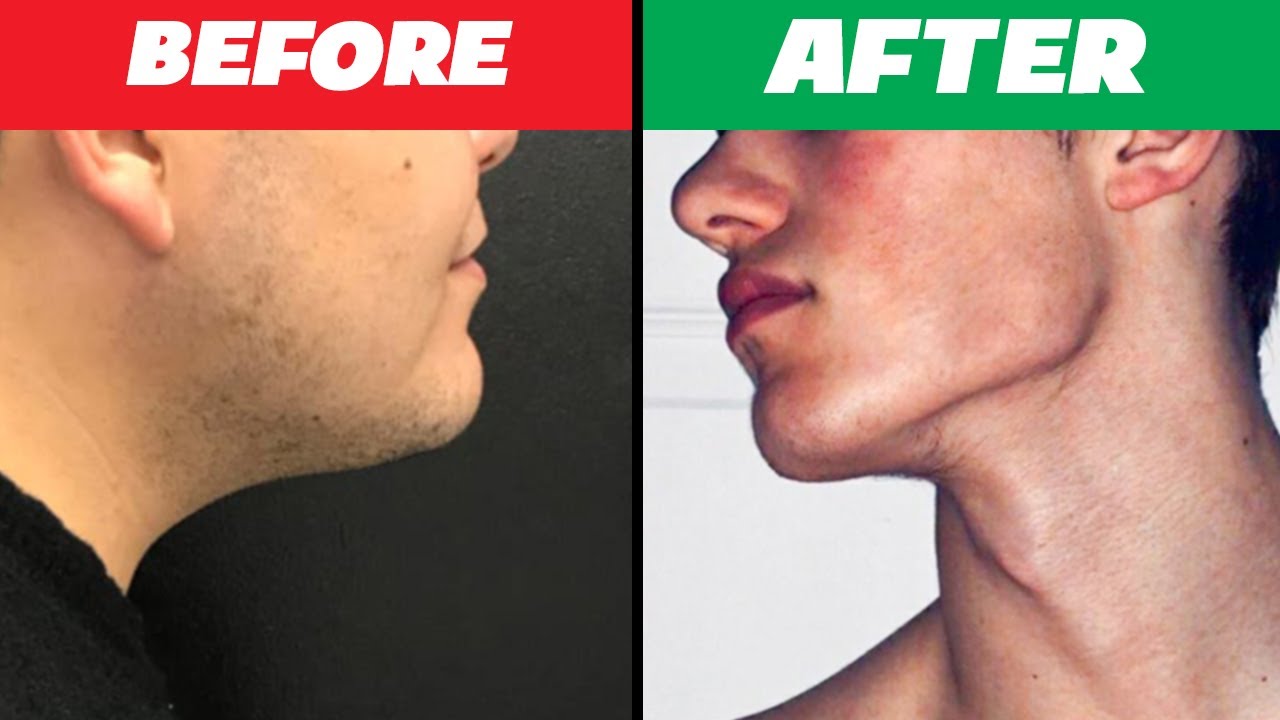 Get Jawline At Home In 2 Minutes step By Step YouTube Get Jawline At Home In 2 Minutes step By Step YouTube