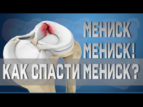 Видео: Разница между мениском и связкой