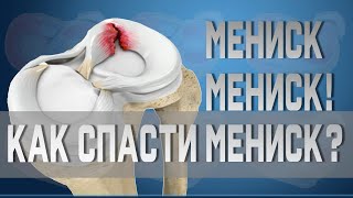 Разрывы, травмы, повреждения мениска. Резать или лечить? | Доктор Демченко