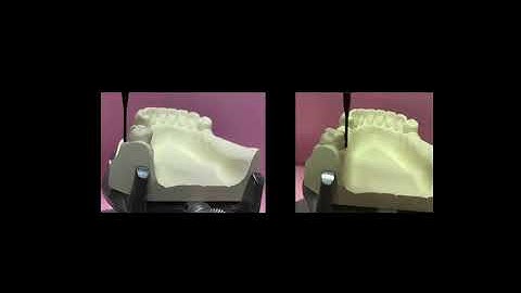 RPD design and drawing---Cast 2 simulation