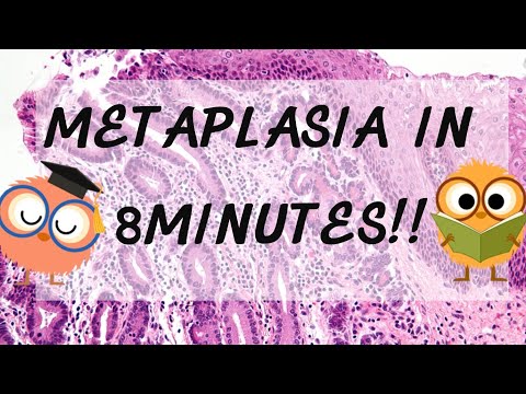 Video: Što od sljedećeg su primjeri metaplazije?