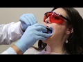 BEYOND Polus Advanced Whitening System (BEYOND Official Authorized Video) - REF.751.3IN.8B