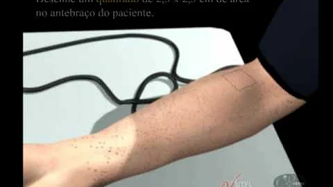 Como é feita a prova do laço?