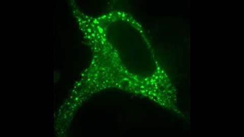 WNKs in Phase Separation