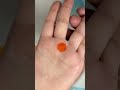bed wetting treatment with colours #healthtips #acupressure #accupressurepoints #colortherapy