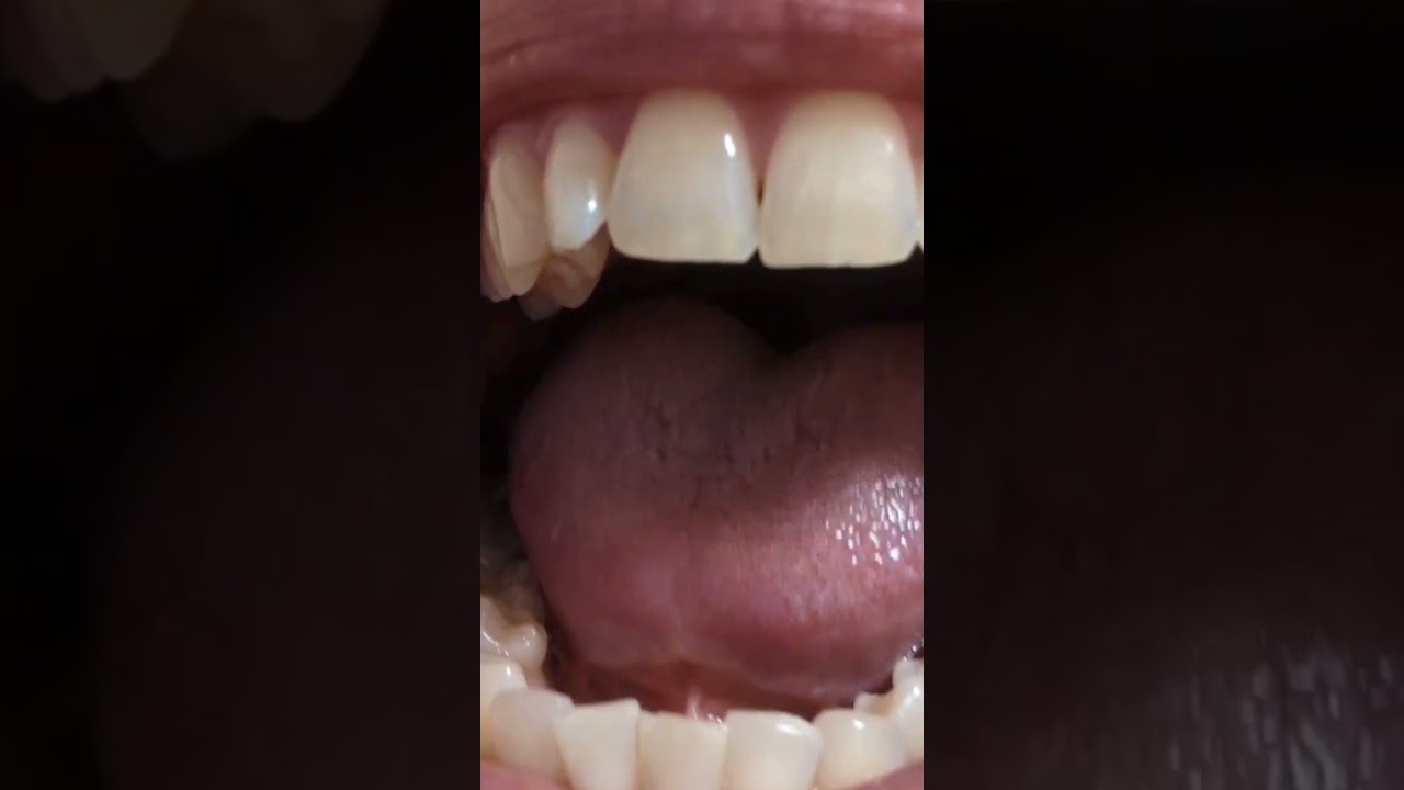 Teeth Tapping Mouth Tour 
