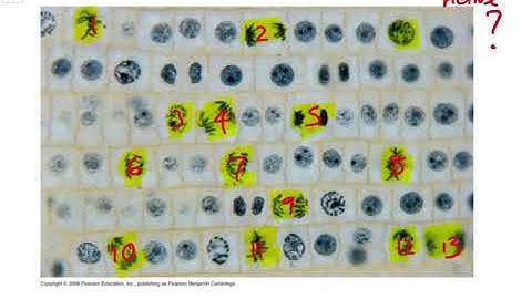 IB Biology Tutorial - 1.6 - Mitotic Index