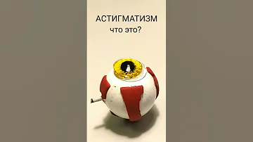 Астигматизм на пальцах #астигматизм #лазернаякоррекциязрения  #миопия