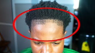 his last barber VIOLATED his hairline! lets fix it!