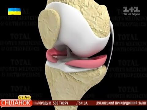 Причини та лікування травм меніска