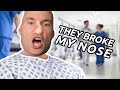 Comedian Talks About his Stress & Nose Operation