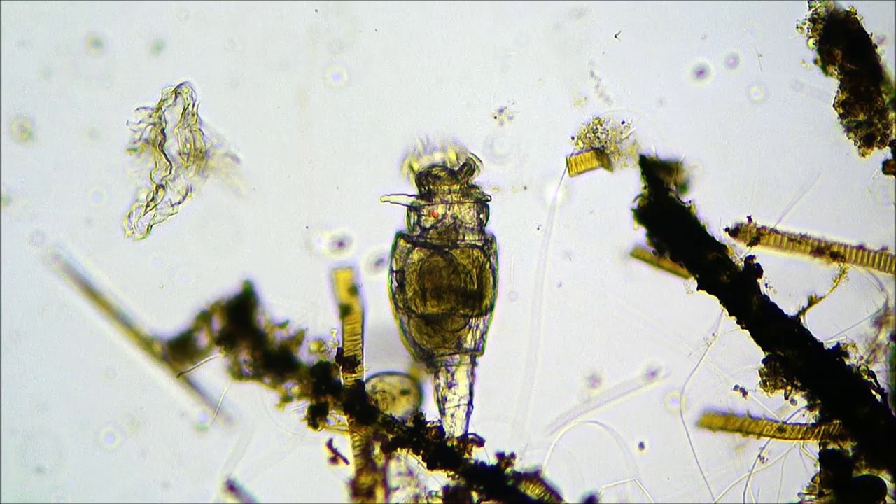 Коловратка Филодина (Philodina)