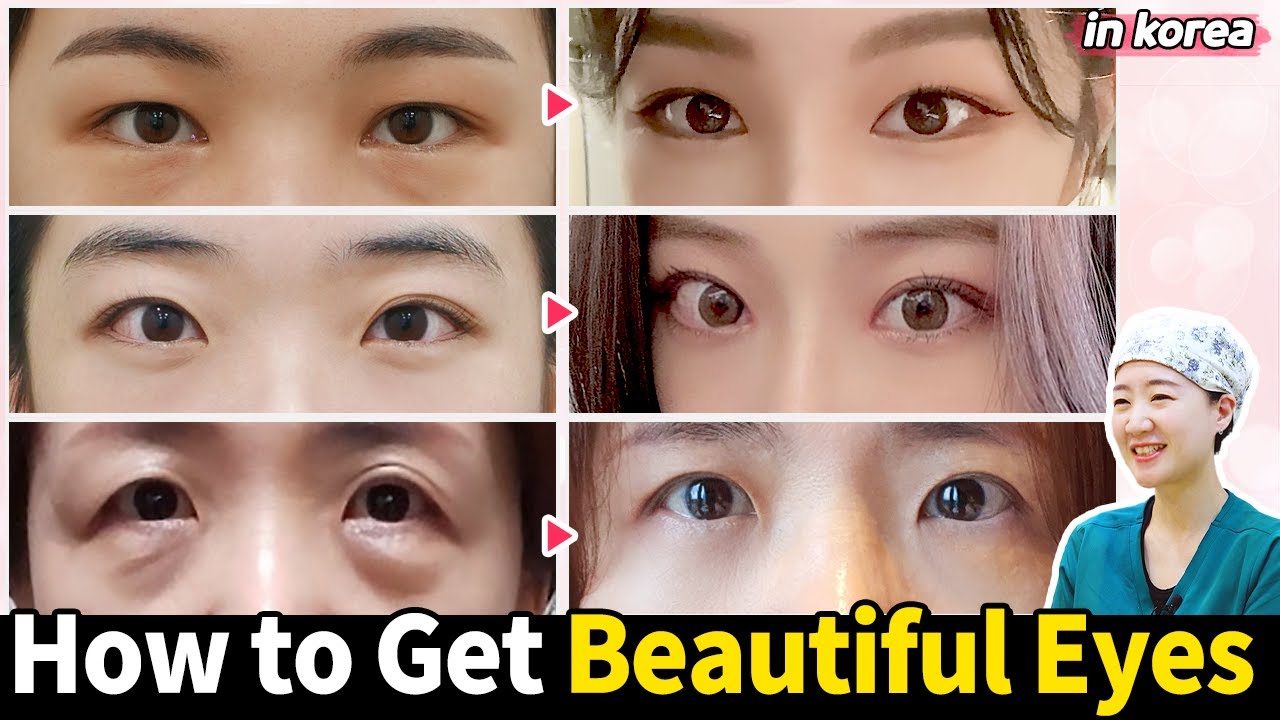 Top 3 Procedures That Work Best with Eye Surgery! 😄👍