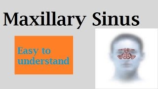 Maxillary sinus