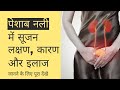 Urethritis in Hindi | Urethritis Symptoms | Urethritis Homeopathic Medicine | Urethritis Treatment