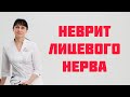 Невропатия лицевого нерва (паралич Белла)