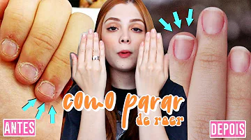 O que fazer com unhas roídas?