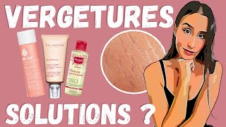COMMENT LES MARQUES DE COSMÉTIQUES VOUS ARNAQUENT AU SUJET DES VERGETURES? CLARINS, MUSTELLA, BI OIL