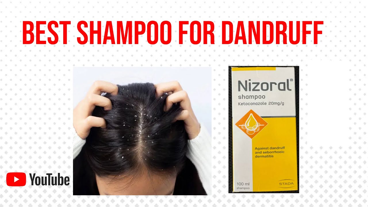 Nizoral shampoo// Antidandruff shampoo//Best anti dandruff shampoo