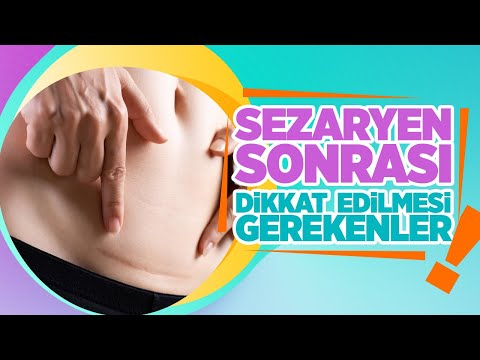 Video: Sezaryen Sonra Cinsi əlaqə Mümkündürmü?