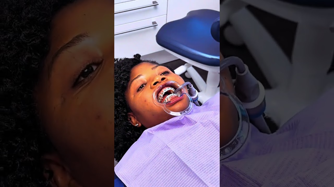 DOCTORS FIX MY  BODY INSECURITY || FINALLY GETTING DENTAL BRACES TO CORRECT MY POOR DENTITION 