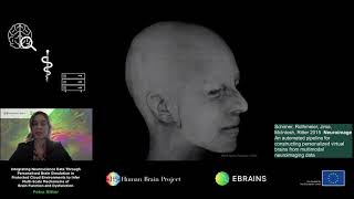 Ritter Petra - Integrating Neuroscience Data Through Personalised Brain Simulation (...)