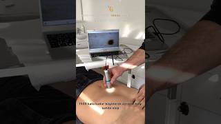 Ben Tedavi̇si̇nde Ücretsi̇z Dermatoskop Muayenesi̇