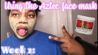 I used the Aztec healing mask| for a month