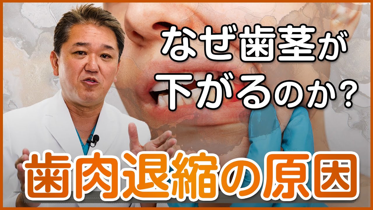 なぜ歯茎が下がるのか？歯肉退縮の原因
