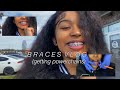 Braces Vlog 🤓 | getting powerchains | N’finidii ♡