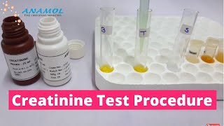 Serum Creatinine Test |  Creatinine Blood Test