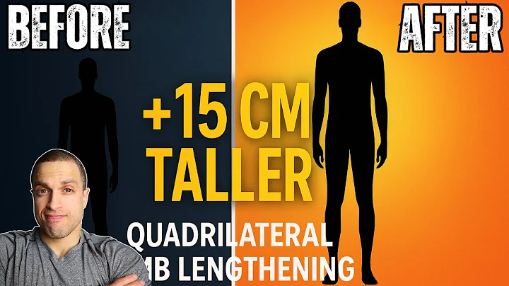 15cm Taller with Cosmetic 'Quadrilateral' Limb Lengthening | Side Quest’s Transformation Story