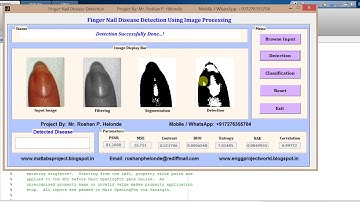 Finger Nail Disease Detection Using Matlab Project code
