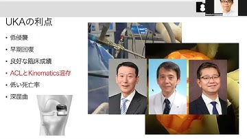 Understanding Kinematic Alignment TKA 2